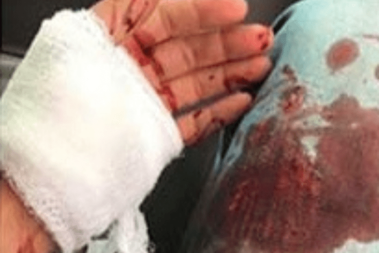 אישה אלימה דקרה את בעלה