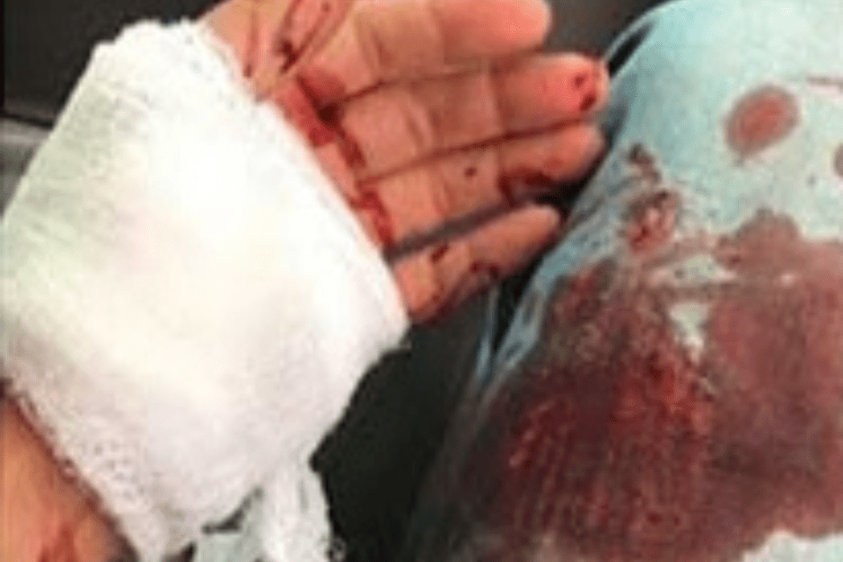 אישה אלימה דקרה את בעלה